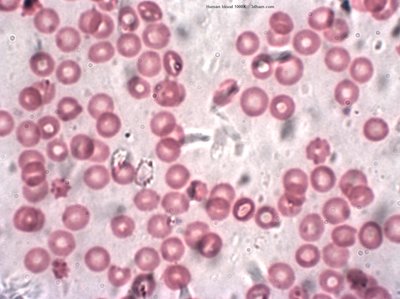 ヒトの赤血球の画像